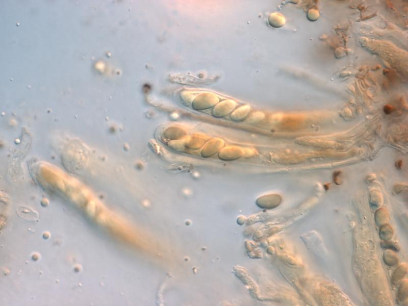 Virtual Mycota Pseudopeziza colensoi